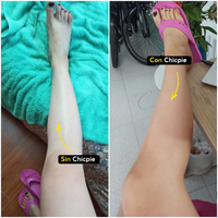 Chicpie Autobronceador