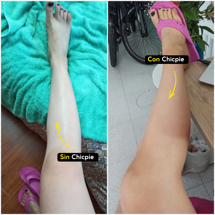 Chicpie Autobronceador