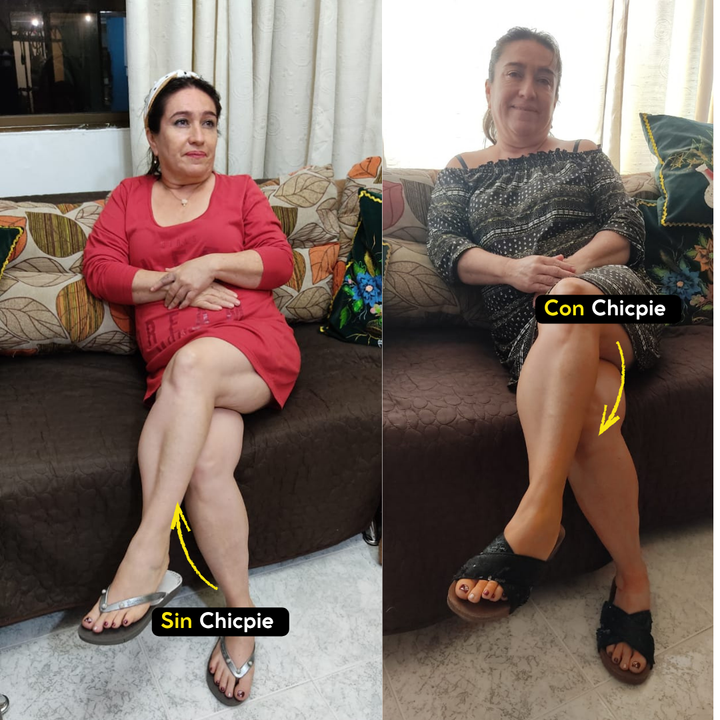 Chicpie Autobronceador